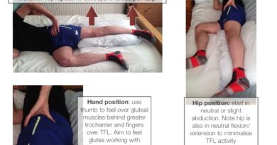 Gluteal tendinopathy exercises to avoid