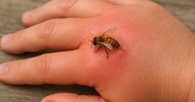 What Does a Bee Sting Look Like