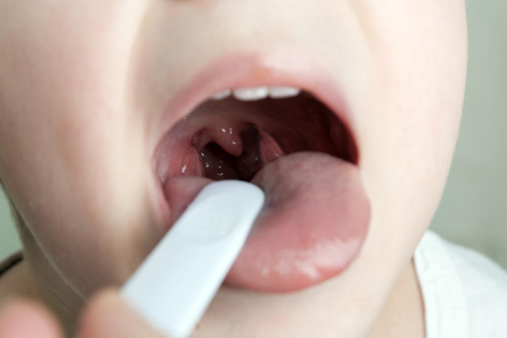 Can Allergies Cause Sore Throat? Causes, Symptoms, Treatment & Everything You Need to Know