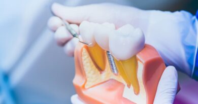Dental Implants Abroad Helvetic Clinics