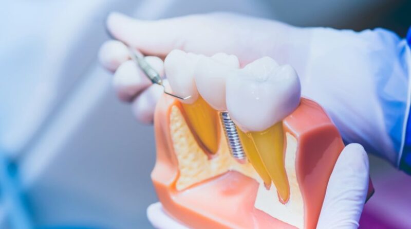 Dental Implants Abroad Helvetic Clinics