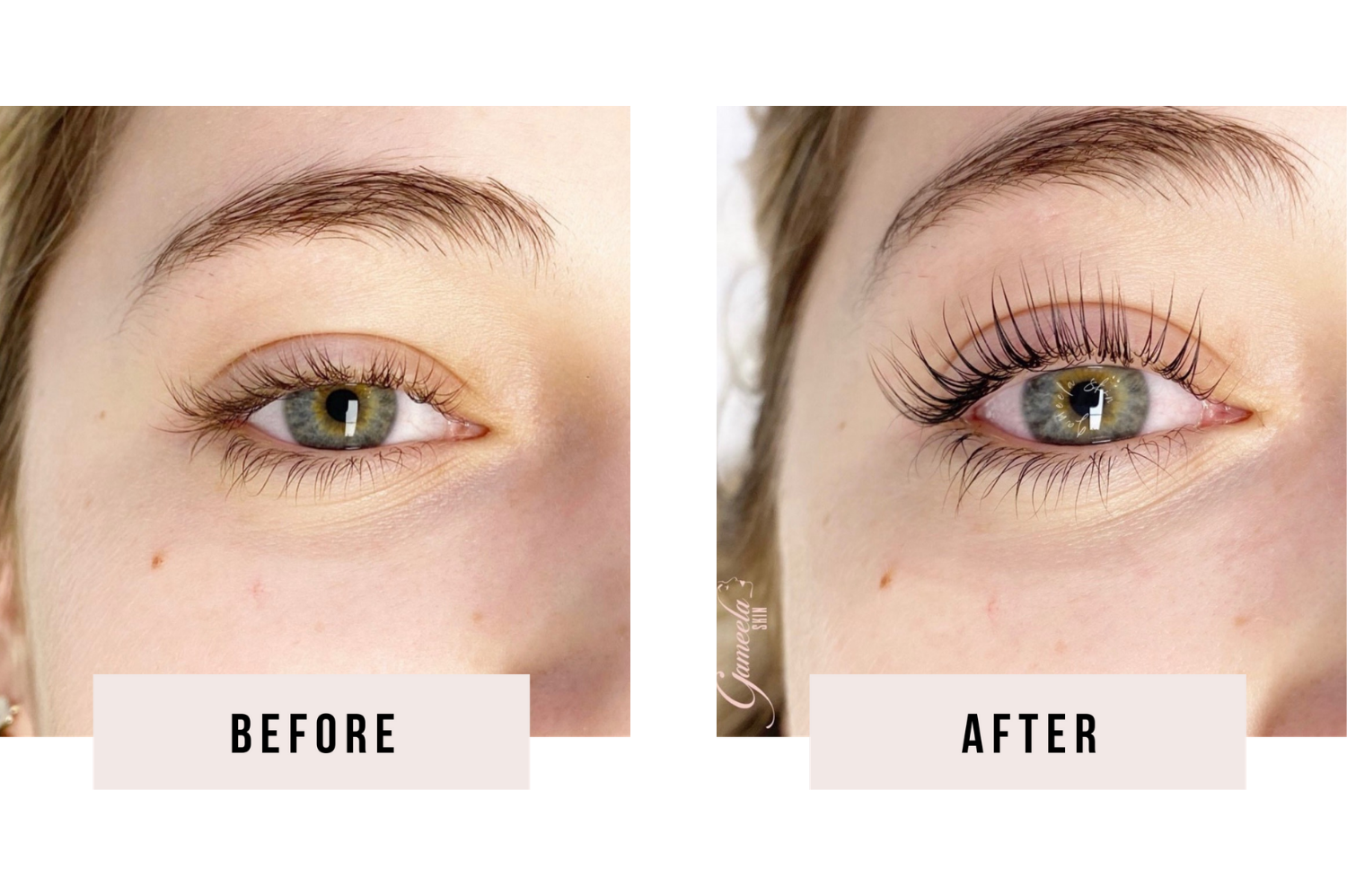 How long does a lash lift last: 6–8 weeks duration, results, and aftercare explained
